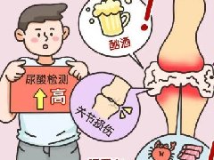 【健康科普】痛风不止是“痛”：科学管理尿酸，预防体内长“石头”