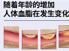 【健康科普】关于血脂，你了解多少？