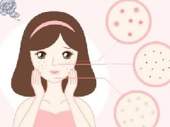 皮肤表面的pH值——守护肌肤健康的“隐形护盾”