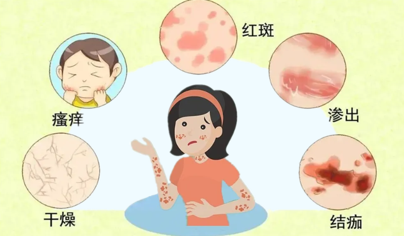 【科普】夏天到啦，你的皮肤还好吗？