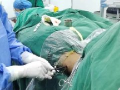 【担当卫健】小切口解决大困扰！微创经皮肾镜取石术为患者解除40余年结石疼