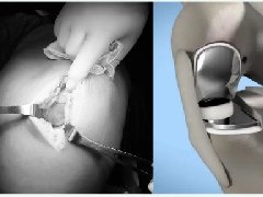 【健康科普】且行且珍“膝”，你的膝关节还好吗？