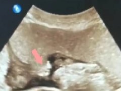 【学科介绍】红河州第二人民医院超声影像科