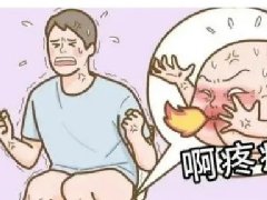 【健康科普】对于肛周脓肿，您了解多少呢？