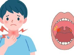 【健康科普】传染性单核细胞增多症：EB病毒的恶魔之吻