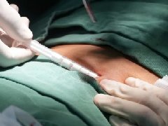 【心理健康科普月月讲】戒酒芯片——开启戒酒新希望