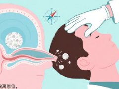 【健康科普】头晕别只查头颈，元凶竟藏在耳朵里