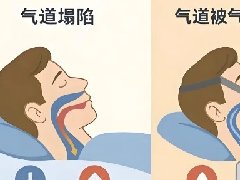 【健康科普】用好呼吸机,保养莫忘记——家用呼吸机维护小技