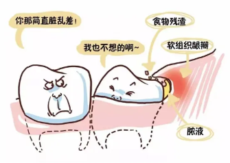 全国爱牙日——关于智齿那些事,你都知道多少?