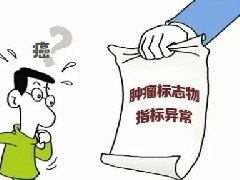 【科普】什么是肿瘤标志物?为什么要做肿瘤标志物检测?