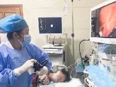【作风卫健】新突破!医院消化内科成功完成首例超声内镜(EUS)及经内镜胃全层切除术(EFTR)