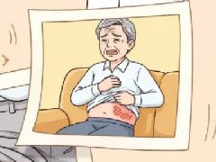 【健康科普】带状疱疹,成年人的隐形暴击