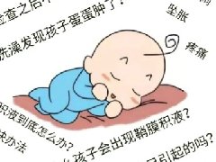 【健康科普】“蛋蛋”一大一小,警惕鞘膜积液